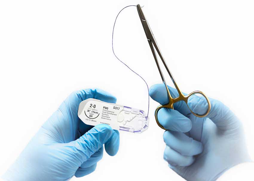 قیمت نخ بخیه PDS در بازار تهران